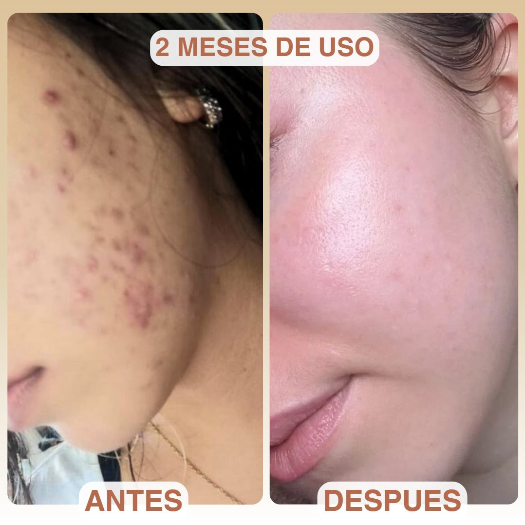 Crema Orpur