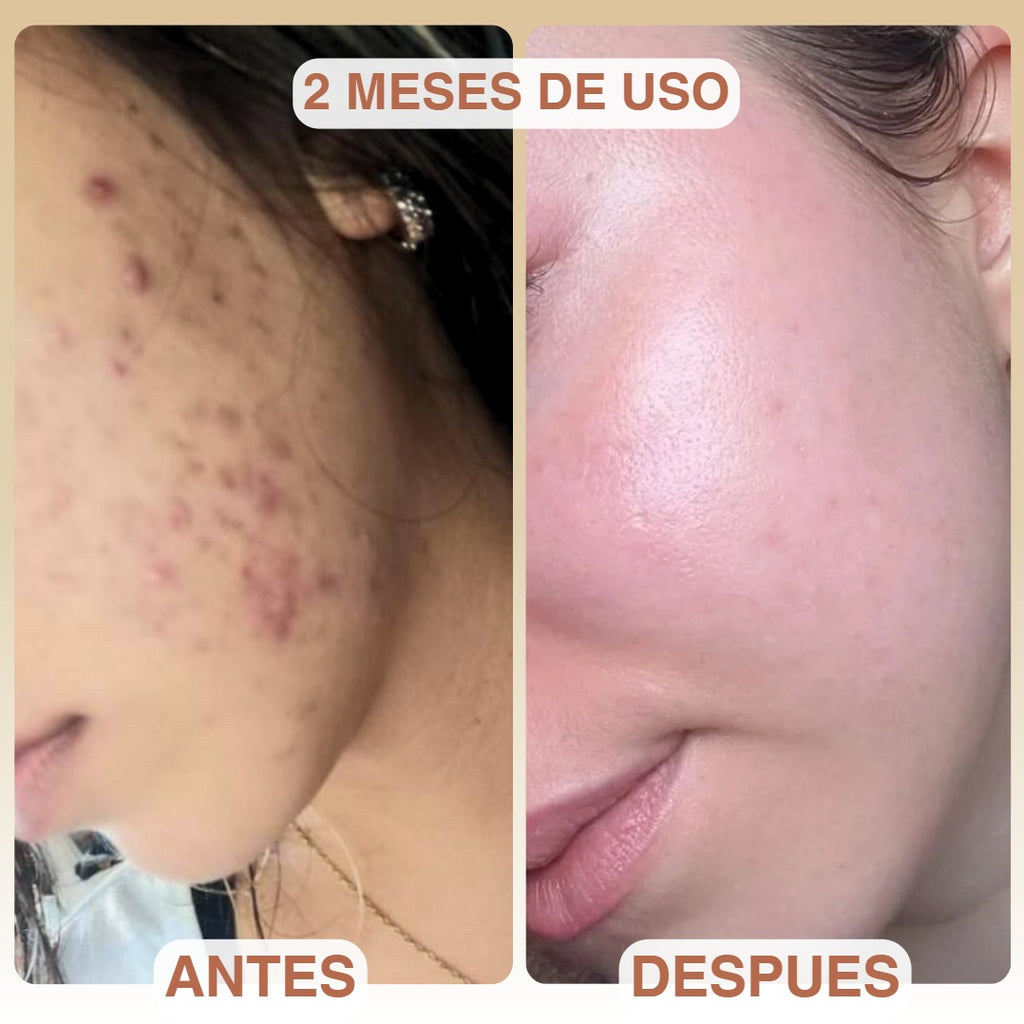 Crema Orpur